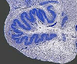 Inferior Olivary Complex