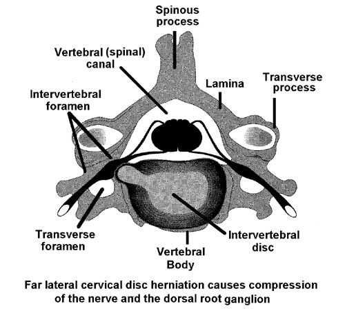 Vertebrae Chart Symptoms