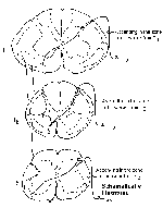 Anterolateral System - Pathway Diagram