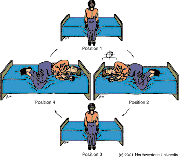 Brandt-Daroff Exercises for BPPV