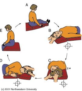 Epley Maneuver